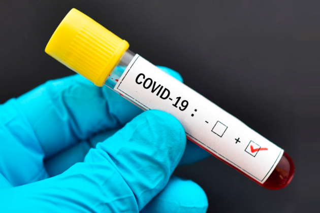 Posicionamento do CFF sobre a comercialização e a realização de testes de covid-19 em farmácias